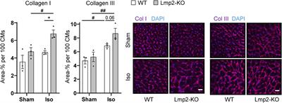 Genetic ablation of Lmp2 increases the susceptibility for impaired cardiac function